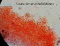Tubaria hiemalis-amf1906-cheilocystides